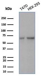 HspA1B Antibody (HSPA1B/7627)