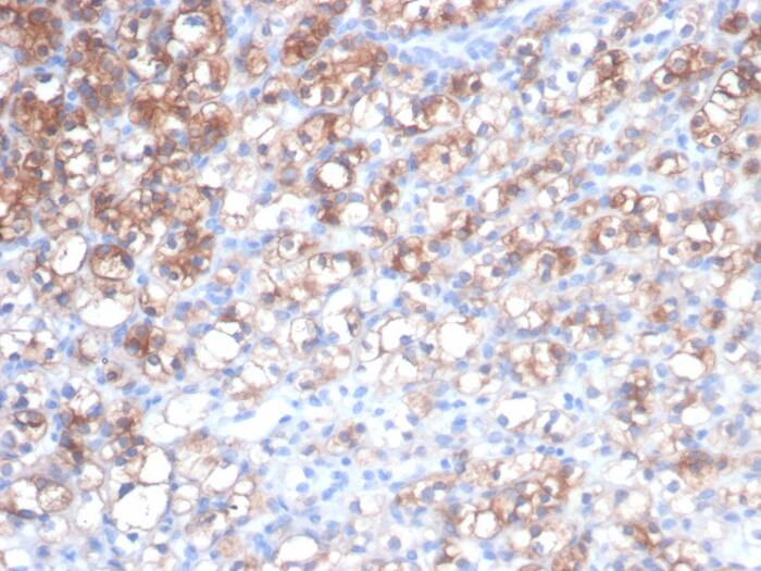 HSP27 Antibody (rHSPB1/7298)