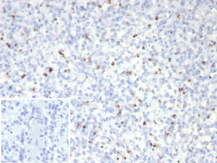 Perforin Antibody (rPRF1/8058) Immunohistochemistry-Paraffin: Perforin Antibody (rPRF1/8058) [NBP3-23638] -