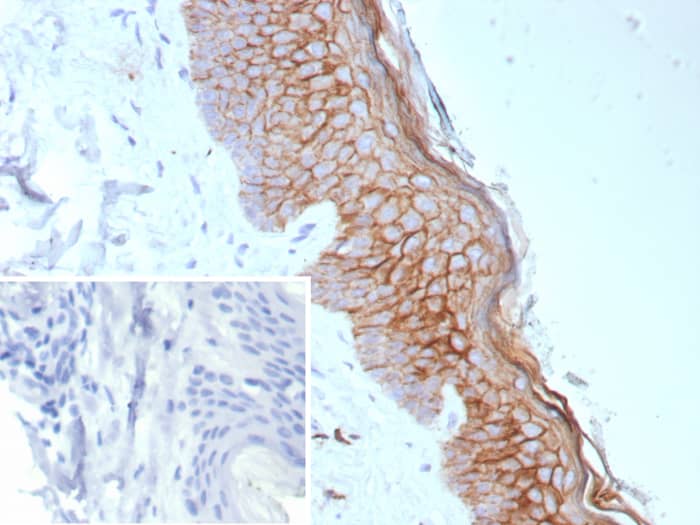 S100 calcium binding protein A14 Antibody (S100A14/9077R)