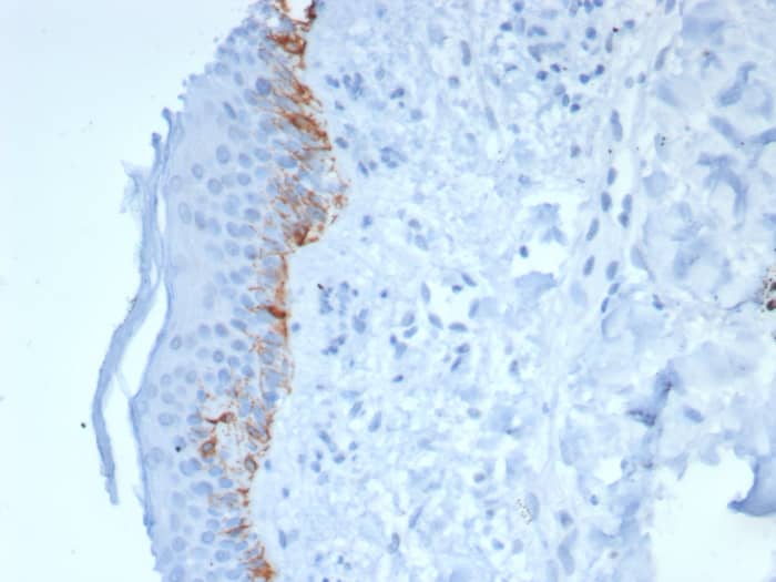 Melan-A/MART-1 Antibody (rMLANA/8180)