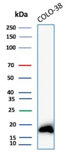 Melan-A/MART-1 Antibody (rMLANA/8180) Western Blot: Melan-A/MART-1 Antibody (rMLANA/8180) [NBP3-23642] -