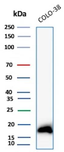 Melan-A/MART-1 Antibody (rMLANA/8180) Western Blot: Melan-A/MART-1 Antibody (rMLANA/8180) [NBP3-23642] -