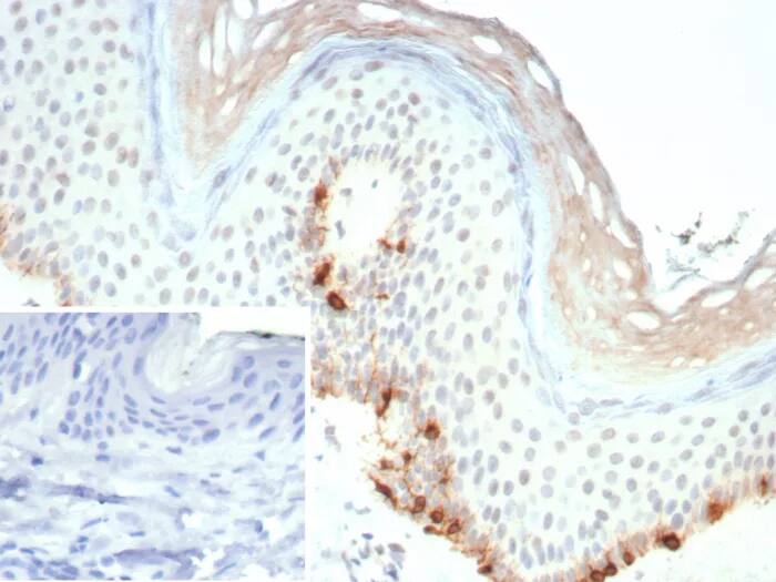 Melan-A/MART-1 Antibody (rMLANA/9404) Immunohistochemistry-Paraffin: Melan-A/MART-1 Antibody (rMLANA/9404) [NBP3-23643] -