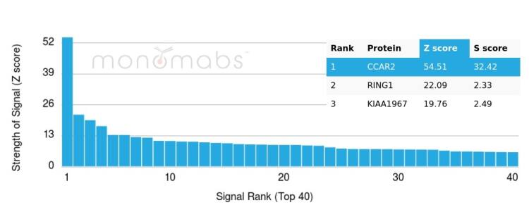DBC1/p30 Antibody (PCRP-KIAA1967-1D10)