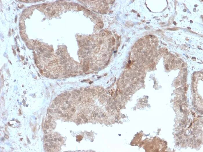 MVP Antibody (r1032) Immunohistochemistry-Paraffin: MVP Antibody (r1032) [NBP3-23652] -