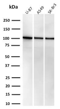 MVP Antibody (r1032) Western Blot: MVP Antibody (r1032) [NBP3-23652] -