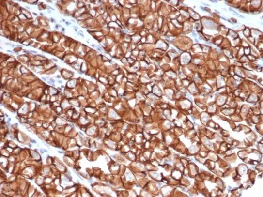 E-Cadherin Antibody (rCDH1/6769) Immunohistochemistry-Paraffin: E-Cadherin Antibody (rCDH1/6769) [NBP3-23653] -