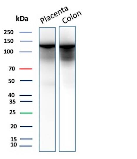 E-Cadherin Antibody (rCDH1/6769) Western Blot: E-Cadherin Antibody (rCDH1/6769) [NBP3-23653] -