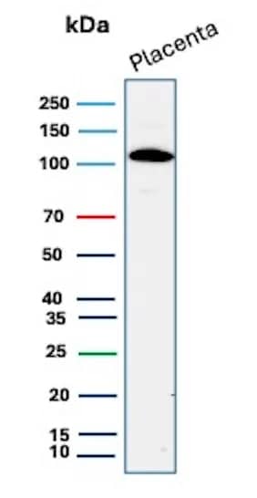 E-Cadherin Antibody (CDH1/9226R) Western Blot: E-Cadherin Antibody (CDH1/9226R) [NBP3-23654] -