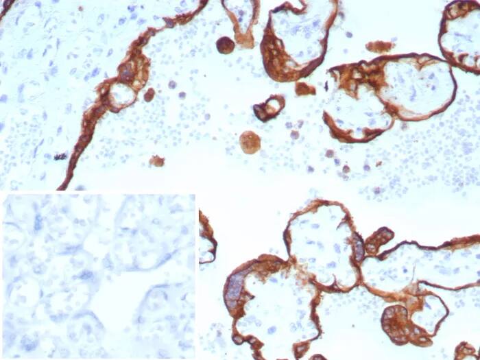 Cytokeratin, LMW Antibody (rKRTL/8751) Immunohistochemistry-Paraffin: Cytokeratin, LMW Antibody (rKRTL/8751) [NBP3-23655] -