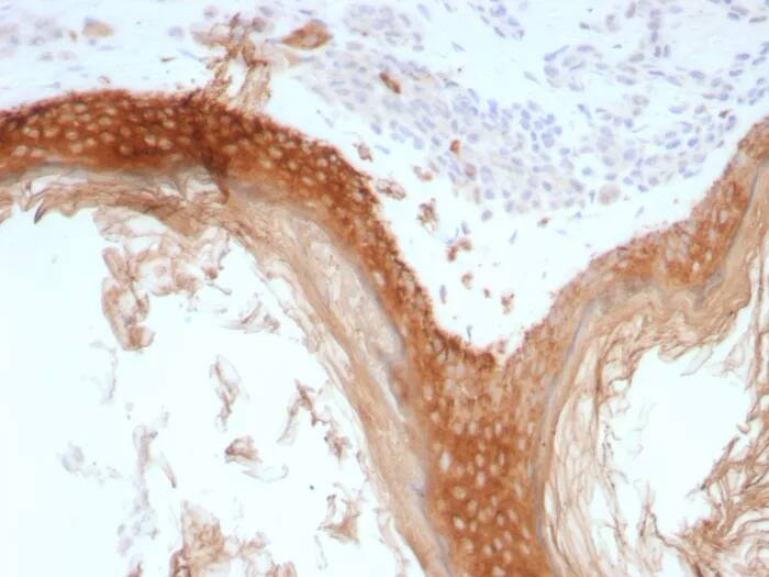 Cytokeratin, HMW Antibody (rKRTH/8883) Immunohistochemistry-Paraffin: Cytokeratin, HMW Antibody (rKRTH/8883) [NBP3-23656] -