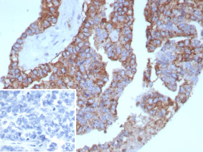 HLA DQ/DR/DP Antibody (rHLA-Pan/8847)