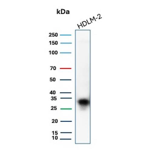HLA DQ/DR/DP Antibody (rHLA-Pan/8847) Western Blot: HLA DQ/DR/DP Antibody (rHLA-Pan/8847) [NBP3-23657] -