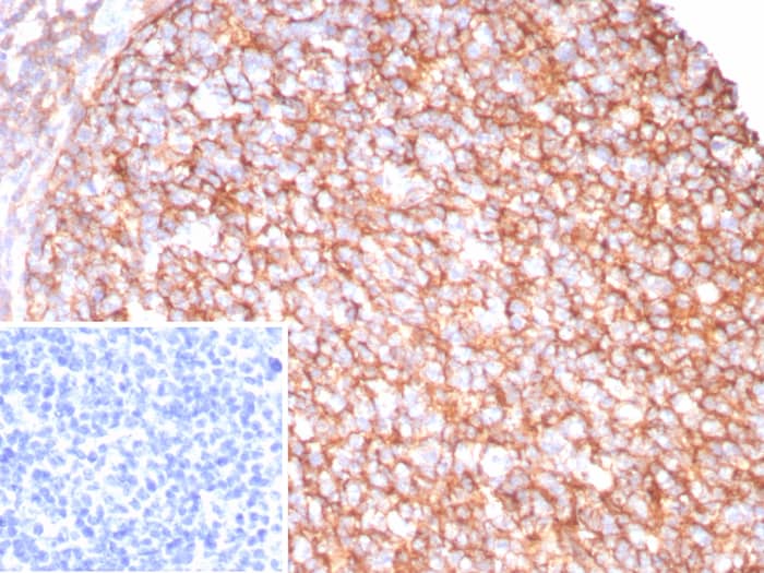 CD21 Antibody (CR2/8880R)