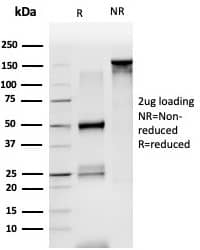 LDB2 Antibody (PCRP-LDB2-1B10)