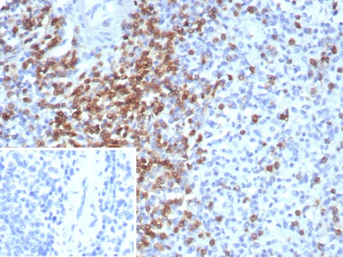 CD2 Antibody (LFA2/8681R)