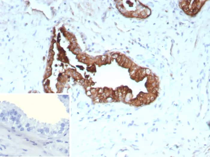 Cytokeratin 19 Antibody (rKRT19/9108) Immunohistochemistry-Paraffin: Cytokeratin 19 Antibody (rKRT19/9108) [NBP3-23666] -