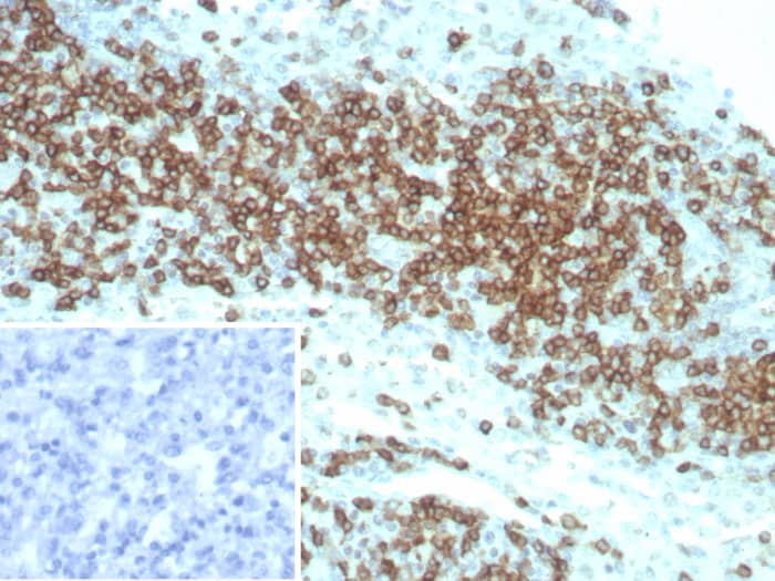 CD2 Antibody (LFA2/8845R)