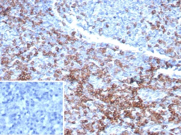 CD3 epsilon Antibody (rC3e/6967) Immunohistochemistry-Paraffin: CD3 epsilon Antibody (rC3e/6967) [NBP3-23677] -