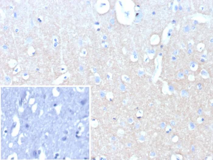 L1CAM Antibody (L1CAM/9146R) Immunohistochemistry-Paraffin: L1CAM Antibody (L1CAM/9146R) [NBP3-23681] -