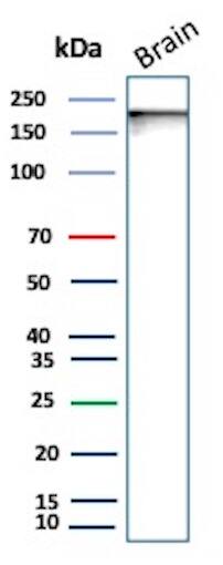 L1CAM Antibody (L1CAM/9146R) Western Blot: L1CAM Antibody (L1CAM/9146R) [NBP3-23681] -