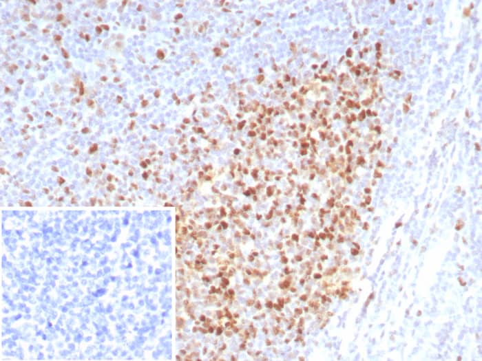 PCNA Antibody (rPCNA/8859)