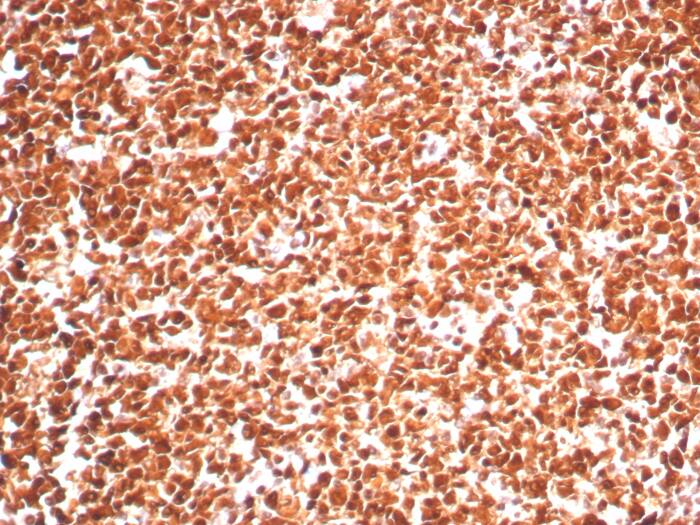 PCNA Antibody (PCNA/8303R)