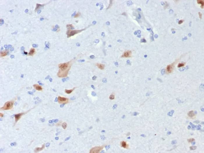 RBFOX3/NeuN Antibody (rNEUN/8054) Immunohistochemistry-Paraffin: RBFOX3/NeuN Antibody (rNEUN/8054) [NBP3-23684] -