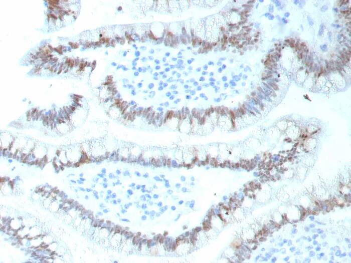 CDX2 Antibody (CDX2/9298R) Immunohistochemistry-Paraffin: CDX2 Antibody (CDX2/9298R) [NBP3-23686] -