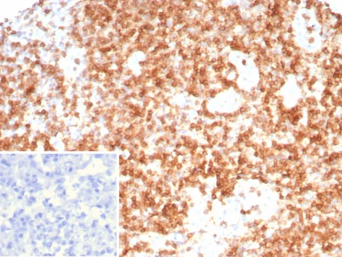 CD3 gamma Antibody (CD3G/8794) Immunohistochemistry-Paraffin: CD3 gamma Antibody (CD3G/8794) [NBP3-23689] -