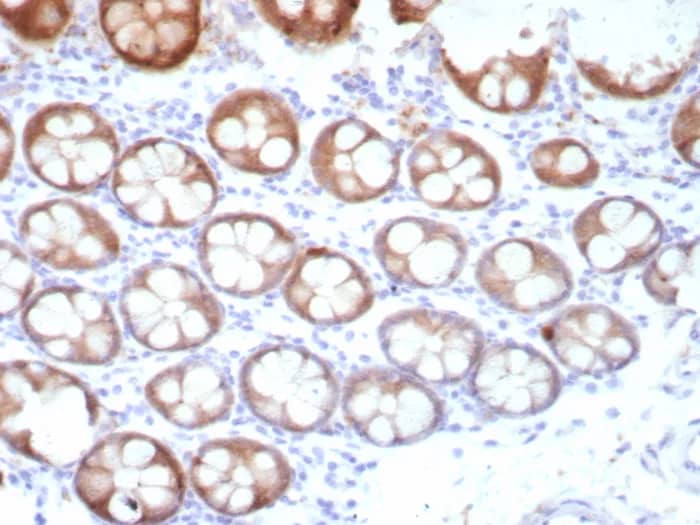 TFF1/pS2 Antibody (TFF1/8817R) Immunohistochemistry-Paraffin: TFF1/pS2 Antibody (TFF1/8817R) [NBP3-23692] -