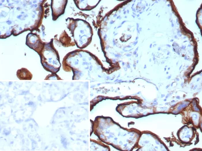 TfR (Transferrin R) Antibody (TFRC/9106R) Immunohistochemistry-Paraffin: TfR (Transferrin R) Antibody (TFRC/9106R) [NBP3-23693] -