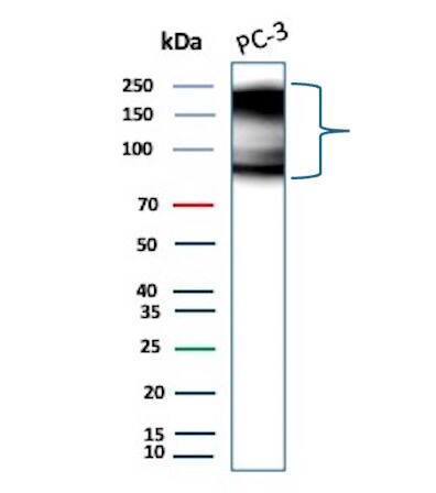 TfR (Transferrin R) Antibody (TFRC/9106R) Western Blot: TfR (Transferrin R) Antibody (TFRC/9106R) [NBP3-23693] -