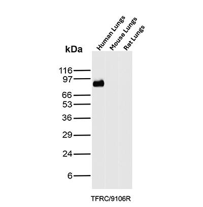 TfR (Transferrin R) Antibody (TFRC/9106R) Western Blot: TfR (Transferrin R) Antibody (TFRC/9106R) [NBP3-23693] -