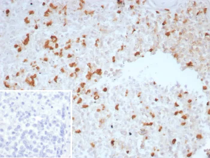 TGF-beta Antibody (TGFB/7230) Immunohistochemistry-Paraffin: TGF-beta Antibody (TGFB/7230) [NBP3-23694] -