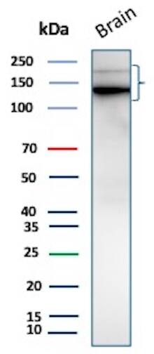L1CAM Antibody (L1CAM/9267R) Western Blot: L1CAM Antibody (L1CAM/9267R) [NBP3-23698] -