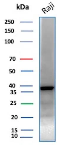 PCNA Antibody (PCNA/8633R) Western Blot: PCNA Antibody (PCNA/8633R) [NBP3-23699] -