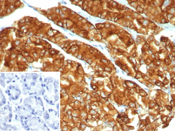 Claudin-18.2 Antibody (CLDN18.2/7300R)