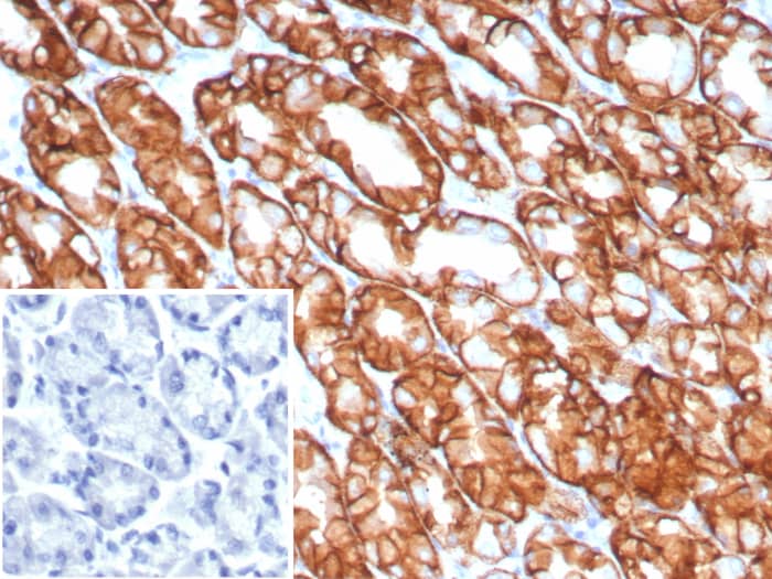 Claudin-18.2 Antibody (CLDN18.2/8141R)