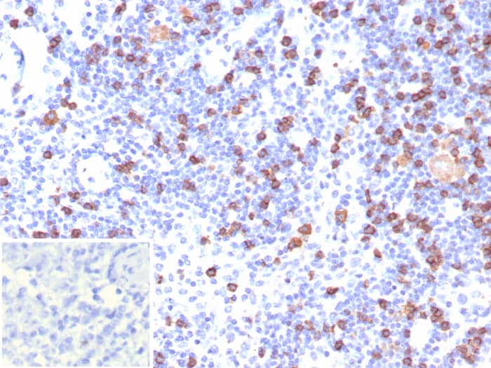 CD8 Antibody (CD8/7793R)