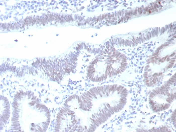 p53 Antibody (rTP53/8993) Immunohistochemistry-Paraffin: p53 Antibody (rTP53/8993) [NBP3-23711] -