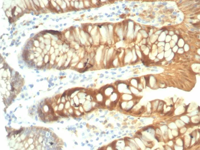 Galectin-3 Antibody (rLGALS3/7286) Immunohistochemistry-Paraffin: Galectin-3 Antibody (rLGALS3/7286) [NBP3-23714] -