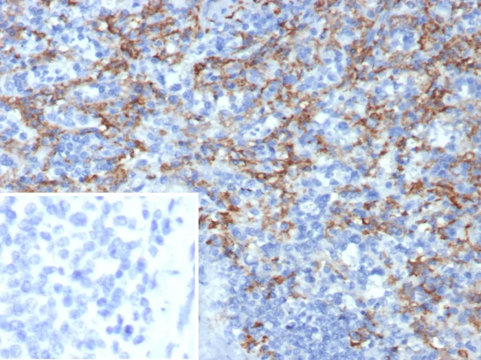 CD163L1 Antibody (CD163L1/7974) Immunohistochemistry-Paraffin: CD163L1 Antibody (CD163L1/7974) [NBP3-23717] -