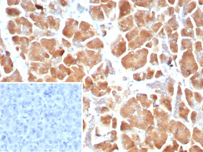 Claudin-18.2 Antibody (CLDN18.2/8559R)