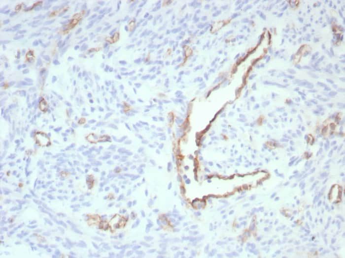 CD31/PECAM-1 Antibody (rPECAM1/8826)