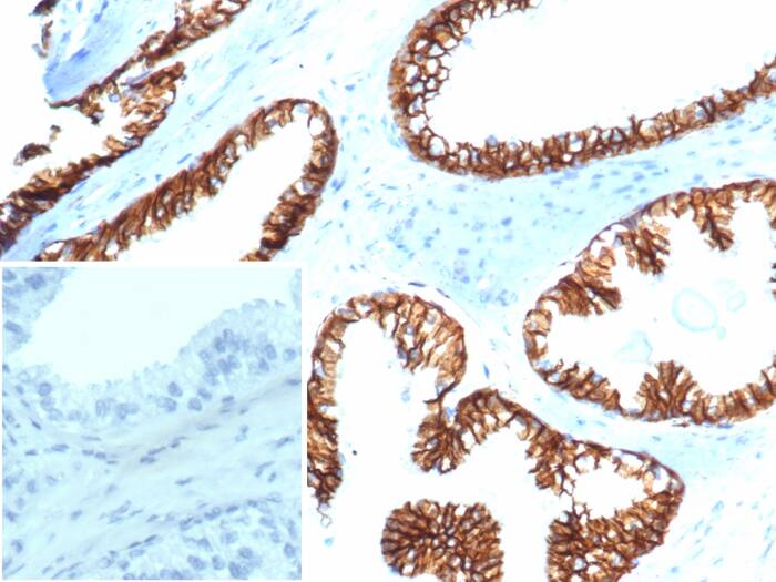 beta-Catenin Antibody (CTNNB1/6807R)