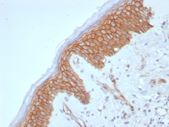beta-Catenin Antibody (CTNNB1/8280R)