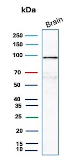 beta-Catenin Antibody (CTNNB1/8280R) Western Blot: beta-Catenin Antibody (CTNNB1/8280R) [NBP3-23721] -
