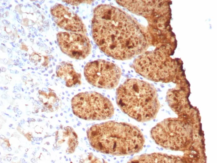 TAG-72 Antibody (rTAG72/9132) Immunohistochemistry-Paraffin: TAG-72 Antibody (rTAG72/9132) [NBP3-23722] -